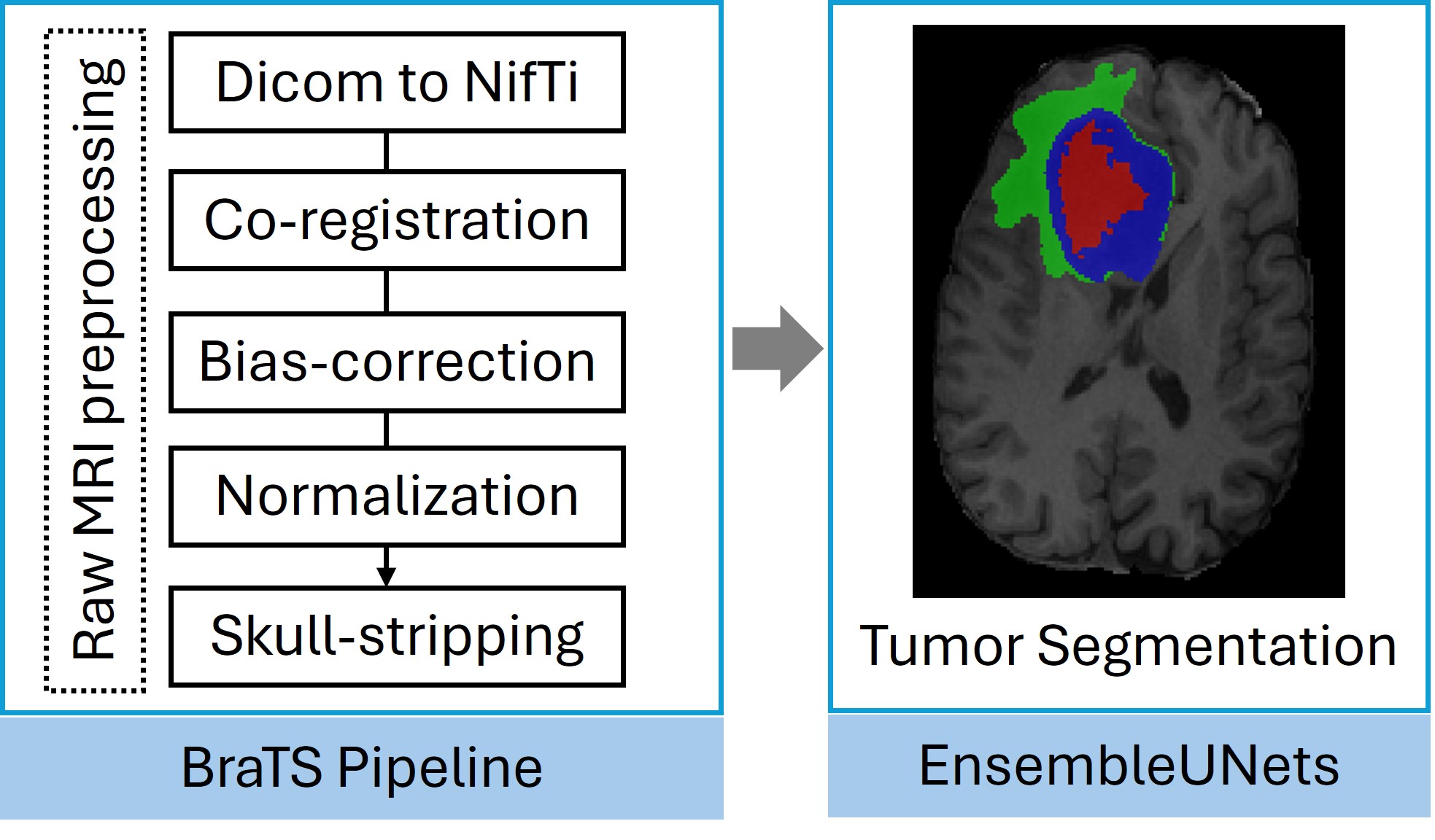 Tumor Segmentation Workflow