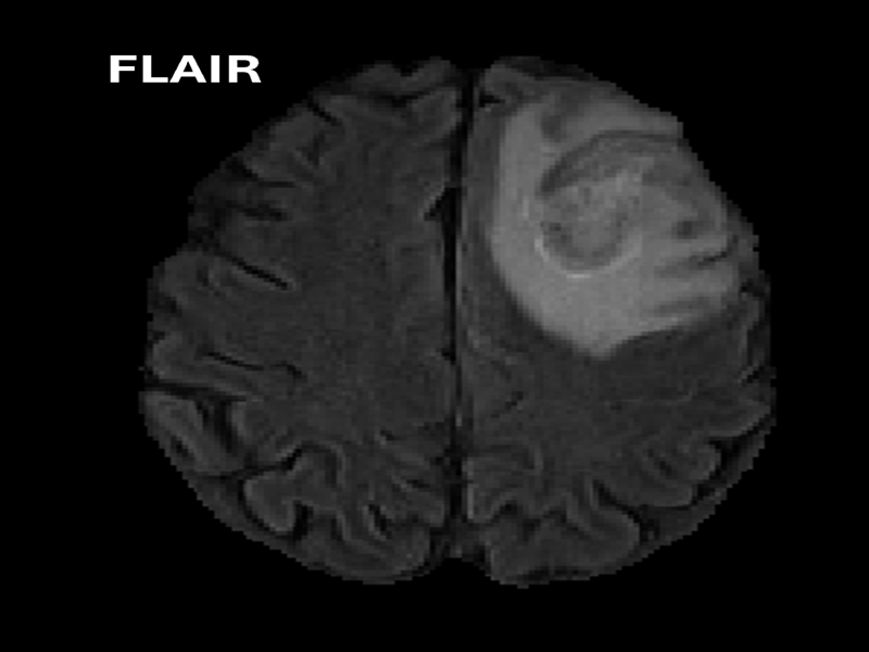 MRI Image 4