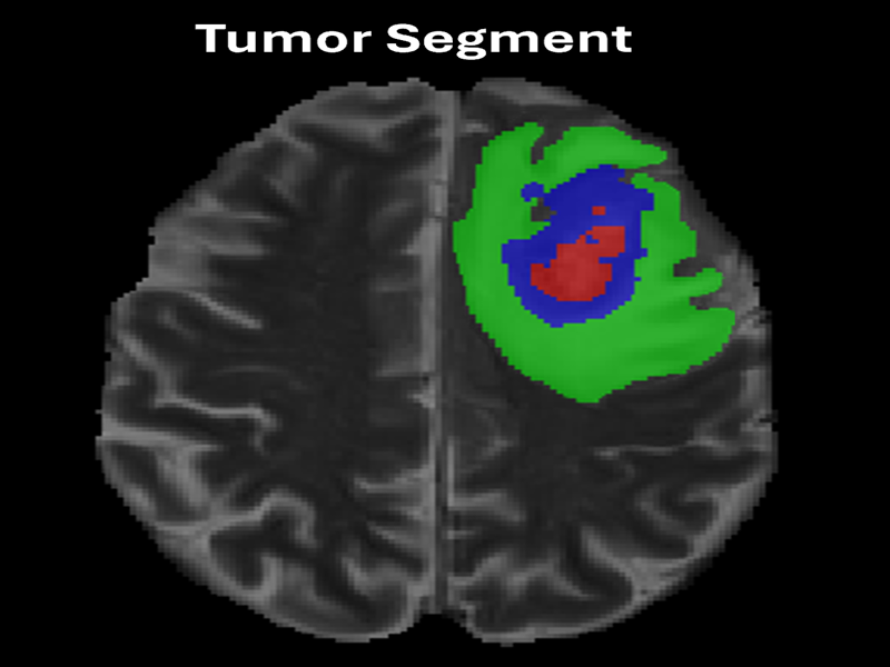 MRI Image 5