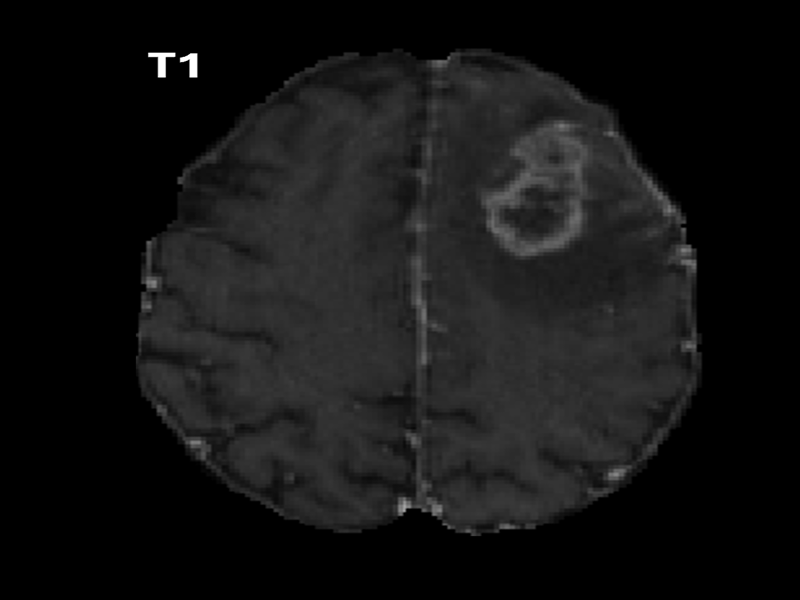MRI Image 1