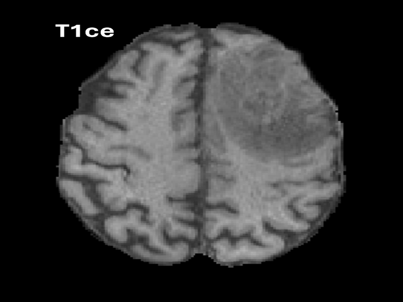 MRI Image 2